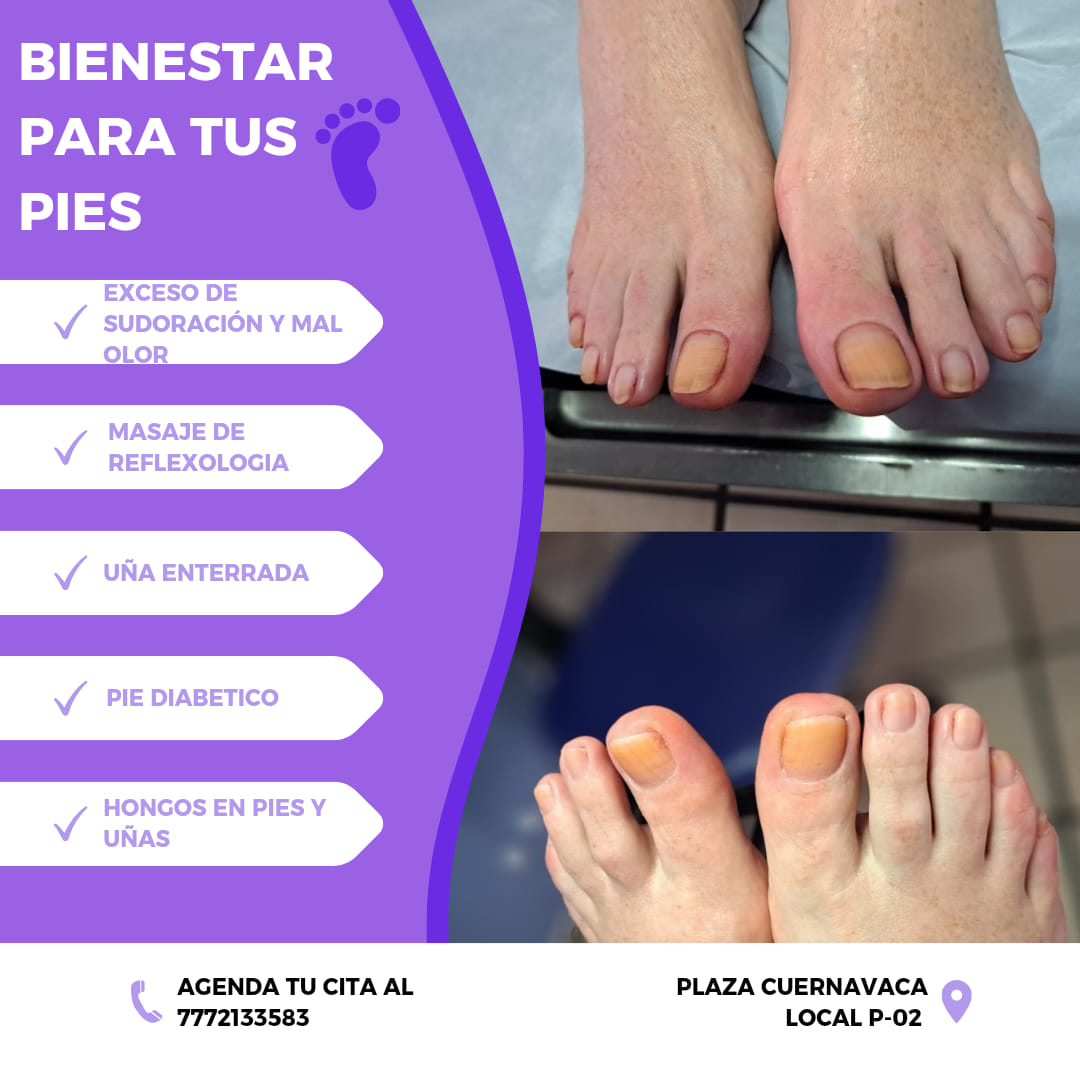 Atención profesional